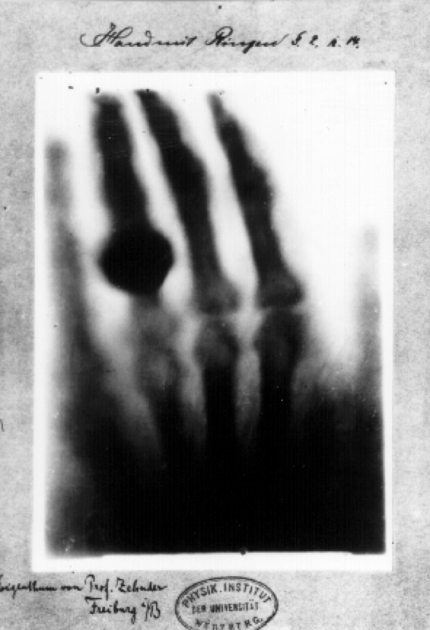 xray xray